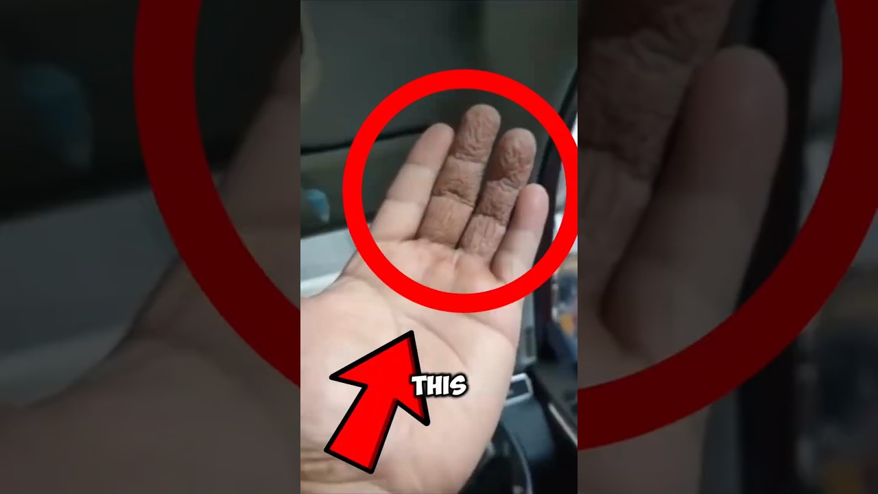 Why Do Fingers Wrinkle But Not Your Palm? 🤯