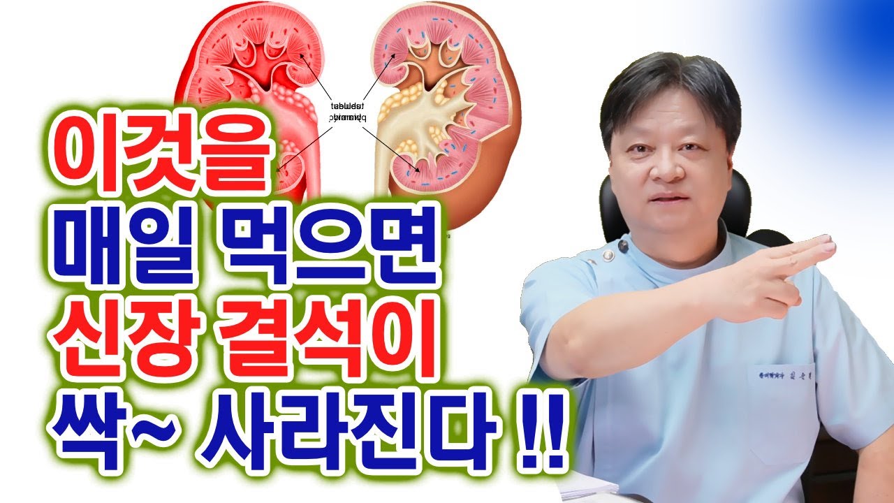 Если вы будете есть это каждый день, камни в почках исчезнут.