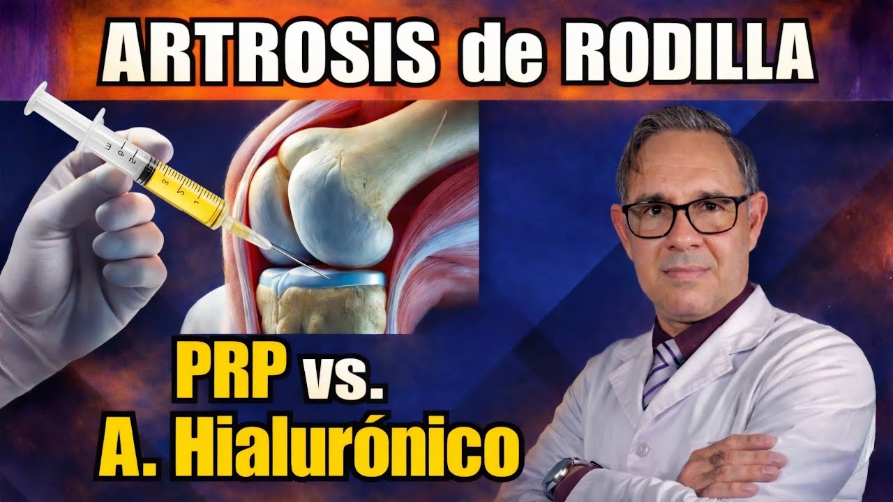 Artrosis de RODILLA - Plasma Rico en Plaquetas (PRP) vs. Ácido hialurónico.