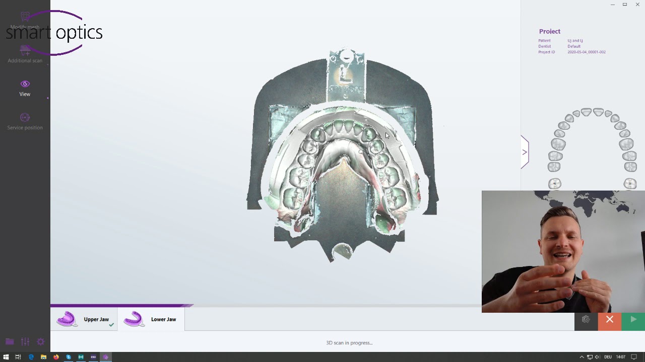 Upper and lower jaw impression scan with alignment in exocad