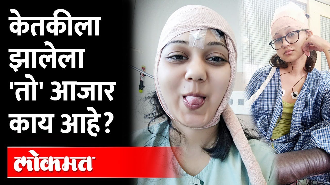 Ketaki Chitale ला झालेला 'तो' आजार काय आहे, लागण कशी होते? Epilepsy | Ketaki Chitale Controversy