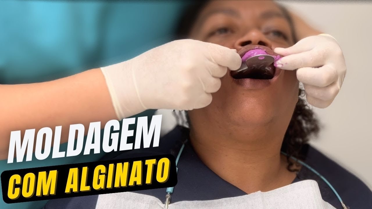 Como moldar com alginato hydrogum | Moldagem odontol&oacute;gica | How to Take an Alginate Impression