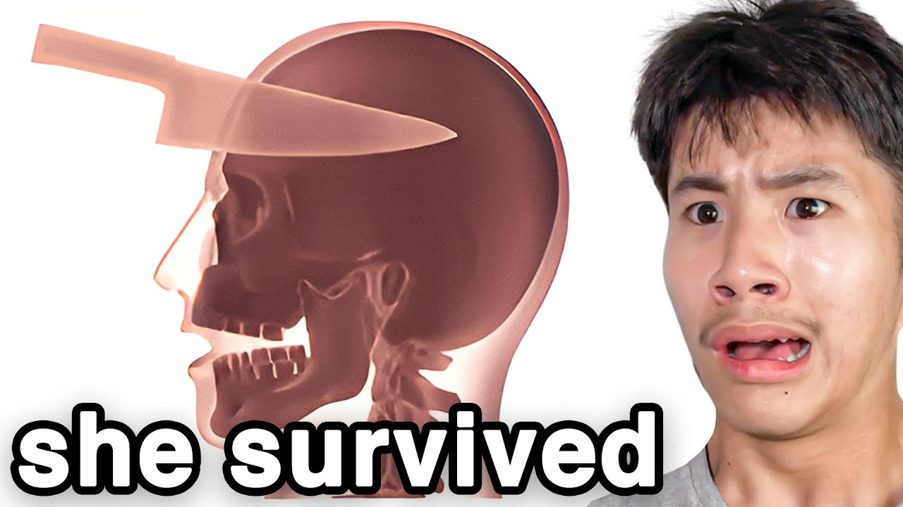 Luckiest People Who Survived The Impossible