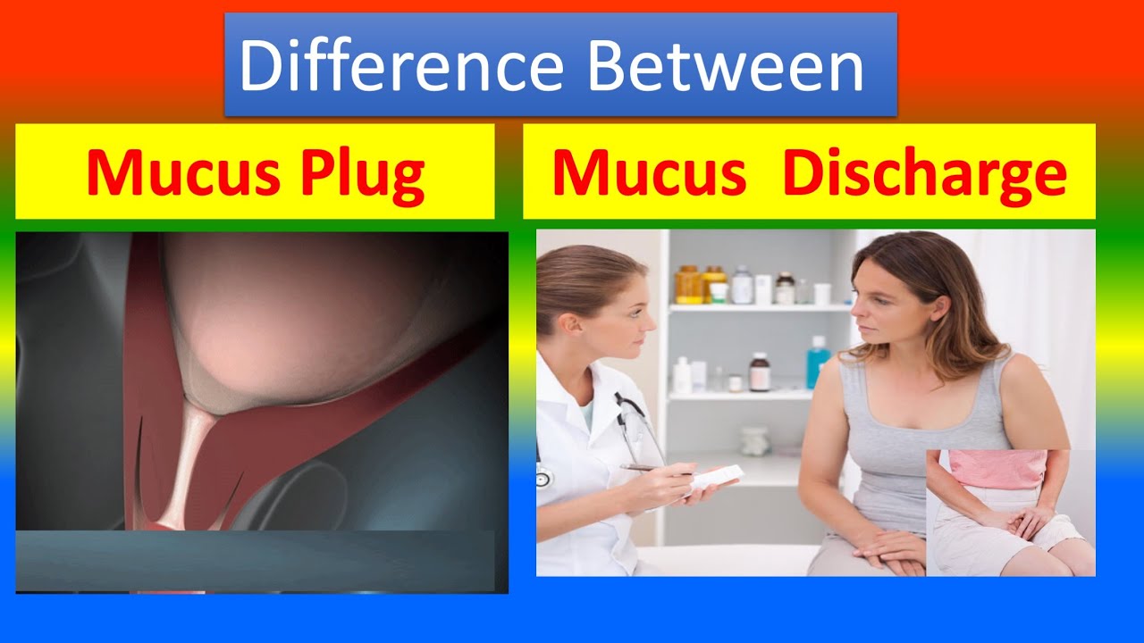 Difference Between vaginal Mucus Plug and vaginal  Discharge
