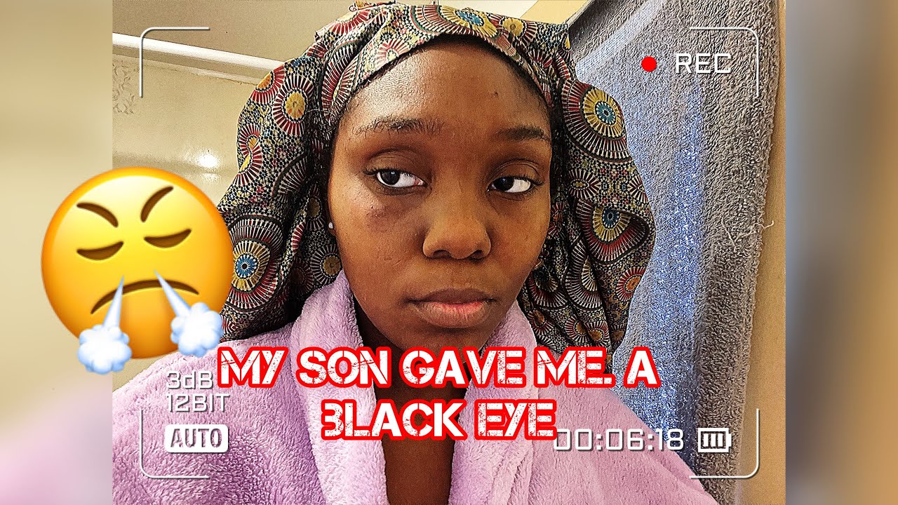 My Son Black My Eye Prank On Boyfriend ‼️