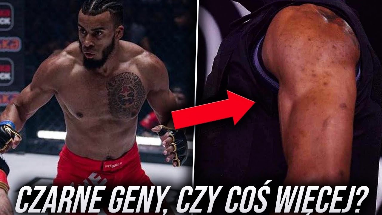 &bdquo;Czarne Geny&rdquo; Czy Coś Więcej? | Alberto Simao