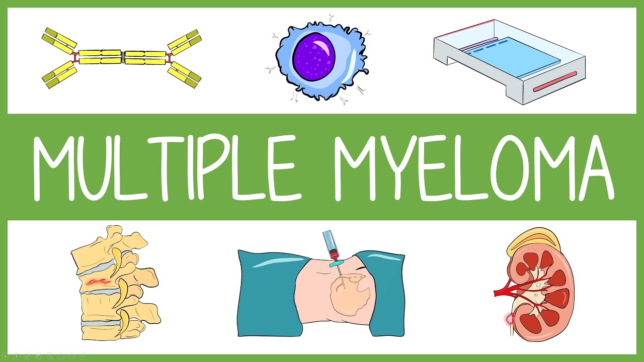 Multiple Myeloma Visually Explained