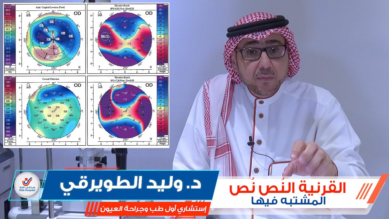 القرنية النُص نُص.. المشتبه بها || د. وليد الطويرقي