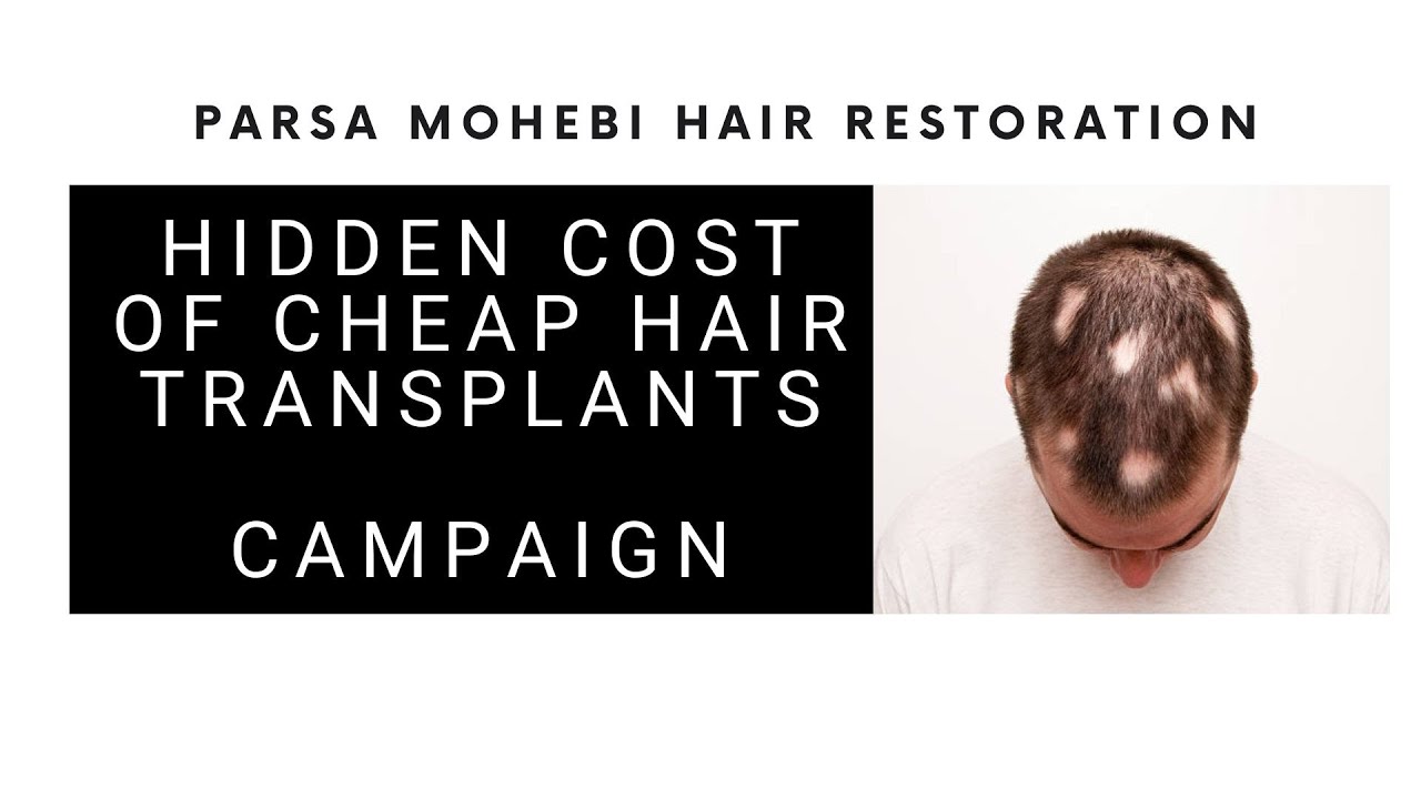 Win a Free Hair Transplant Repair ! - &ldquo;The Hidden Cost of Cheap Hair Transplants