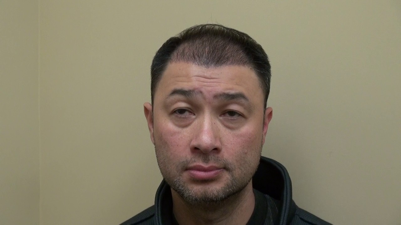 Hair Transplant 3rd Month Follow Up Surgery Progress Dr. Diep http://www.mhtaclinic.com