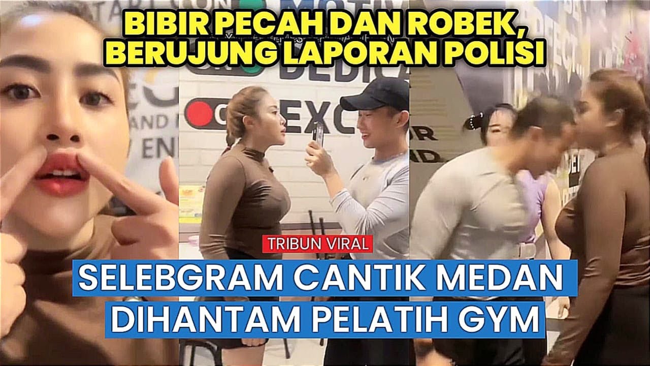 Viral Selebgram Medan Alami Luka di Bibir Usai Cekcok dengan Pelatih Gym, Laporan Polisi Dilayangkan