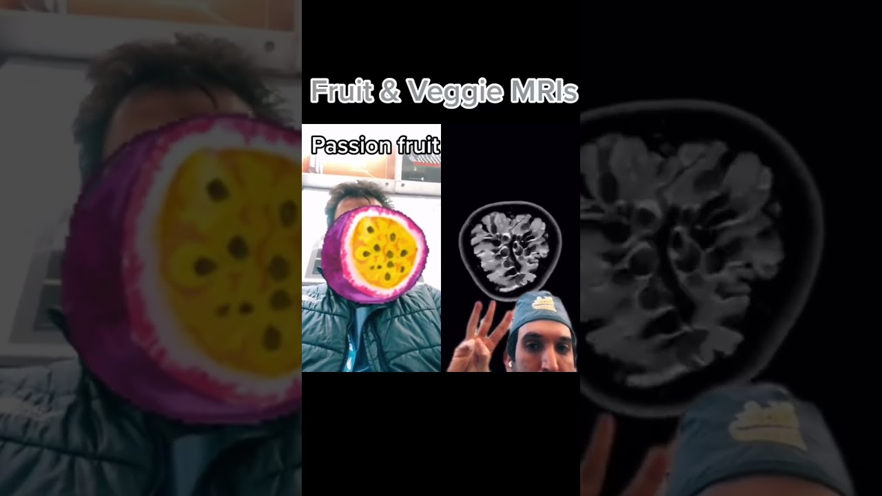 Fruit & veggie MRI answer key