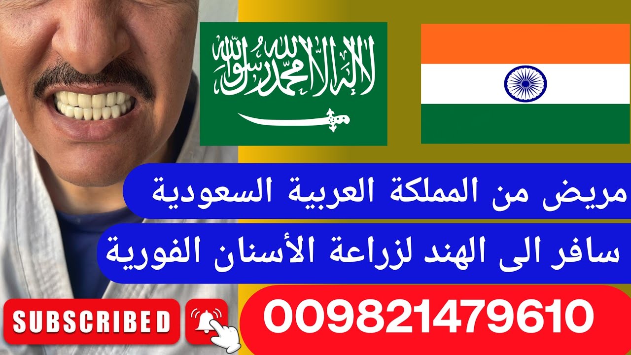 مريض من المملكة العربية السعودية سافر إلي الهند لزراعة الأسنان الفورية في الهند #اسنان #علاج #زراعة 