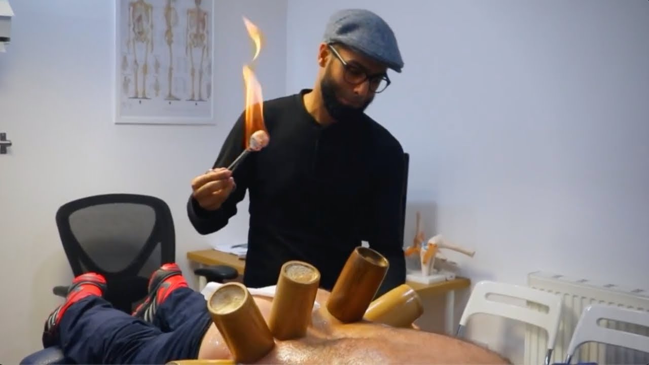 Fire Cupping & Adjustments | Disk Bulges in Lumbar Spine  | Clinical Application of Therapies!