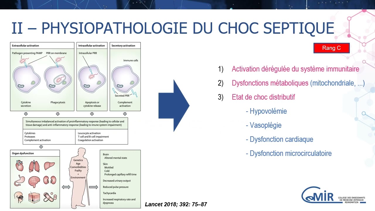 3 11 1 Sepsis et choc septique : généralités et étiologies