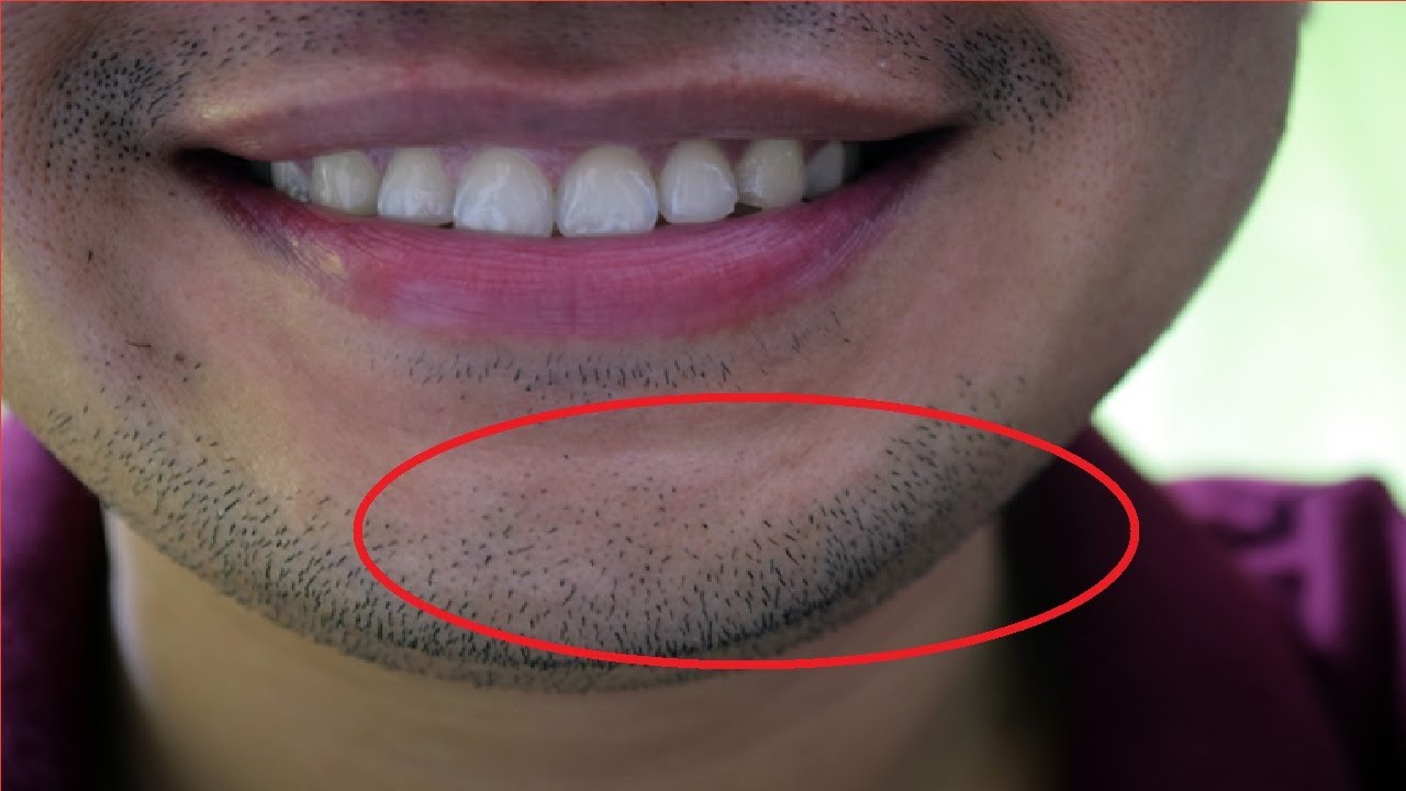 how to get rid of after shave shadow
