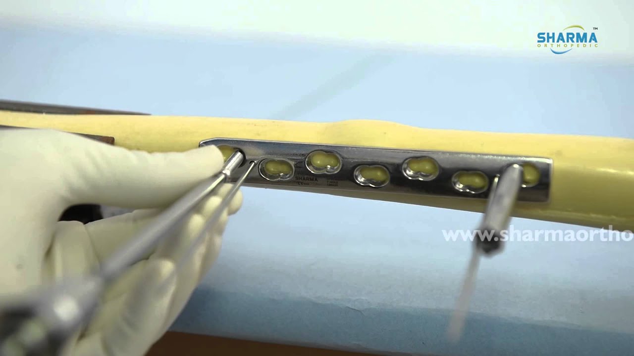 Dynamic Compression Locking Plate- DCP BROAD