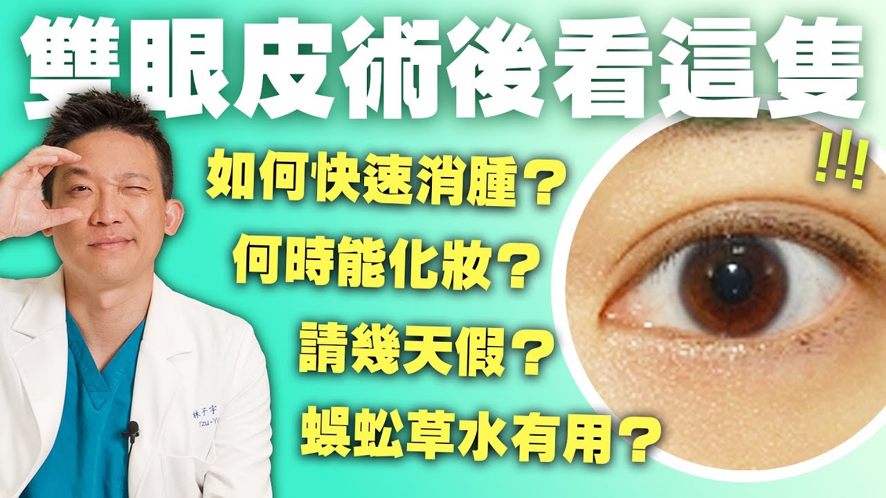 縫雙眼皮能全身麻醉？幾天戴隱形眼鏡？ 割雙眼皮要拆線嗎？一次解答所有疑惑！｜新聖整形外科 林子宇醫師