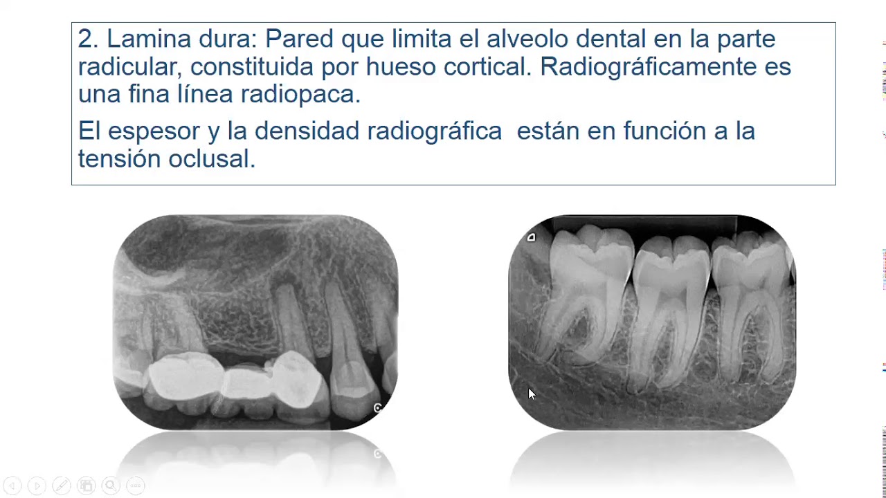 Clase virtual. Unidad 7. Anatomía radiológica normal. (29/05/2020)