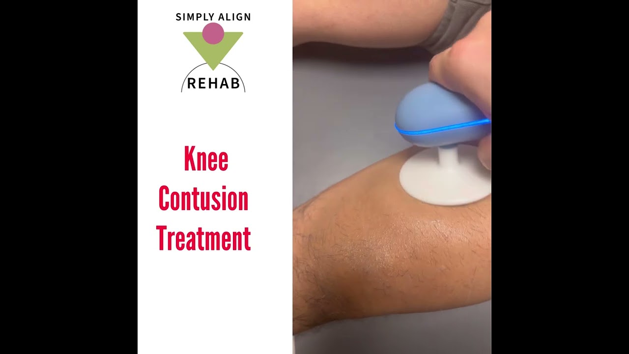 Knee Contusion Treatment