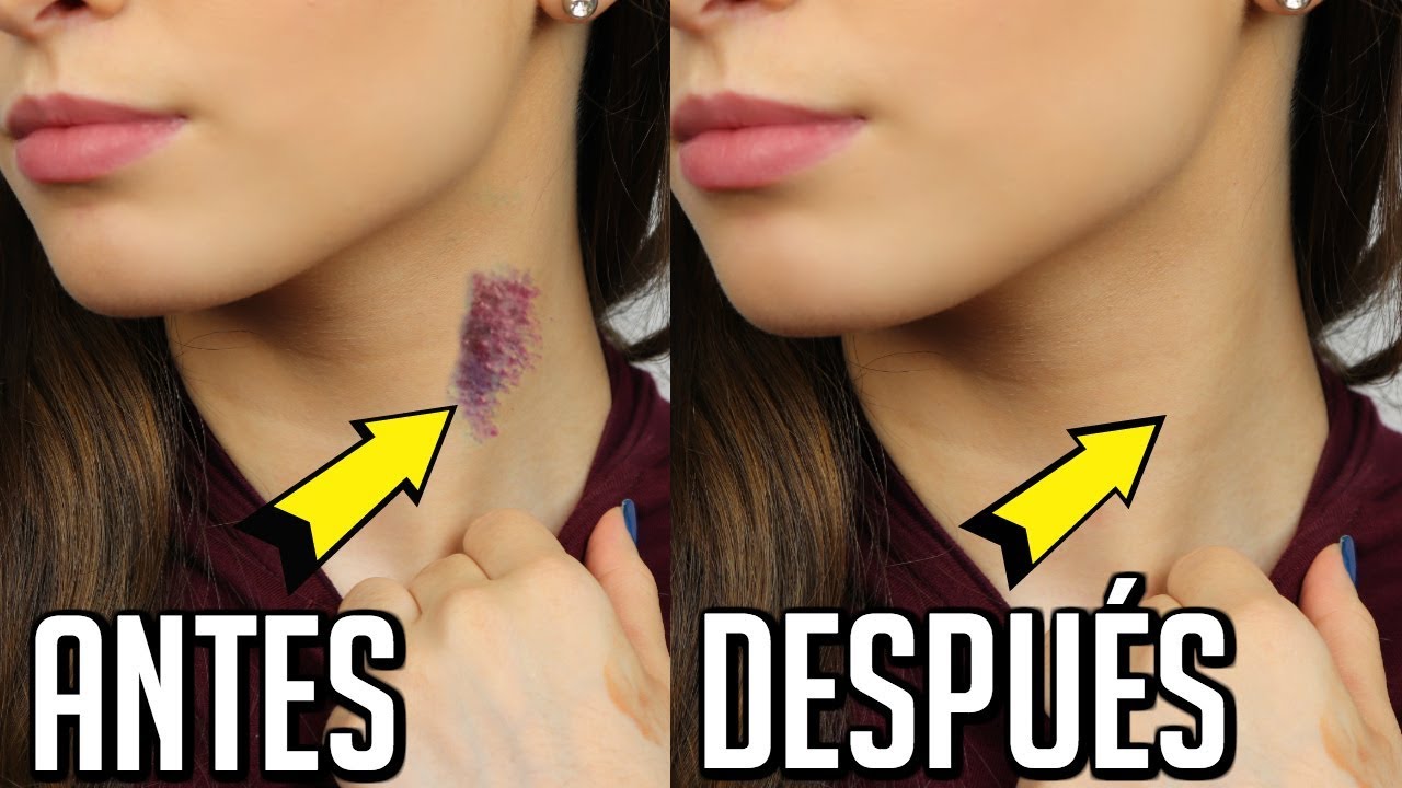 COMO QUITAR UN CHUPETON DEL CUELLO | TRUCOS DE MAQUILLAJE | LAURA MEJIA