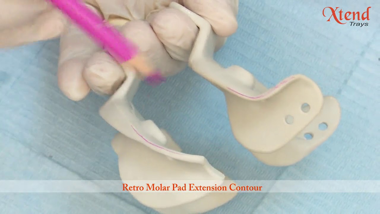Complete Denture impression procedure using X tend Trays