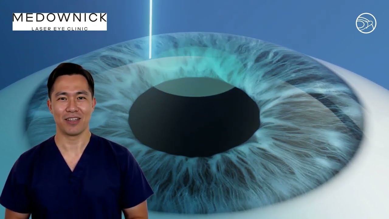 What is SmartSight laser eye surgery?