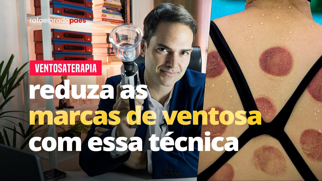 O SEGREDO QUE MELHORA A APLICAÇÃO DAS VENTOSAS