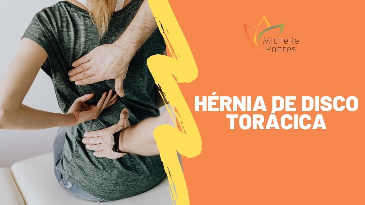 Hérnia de Disco Torácica