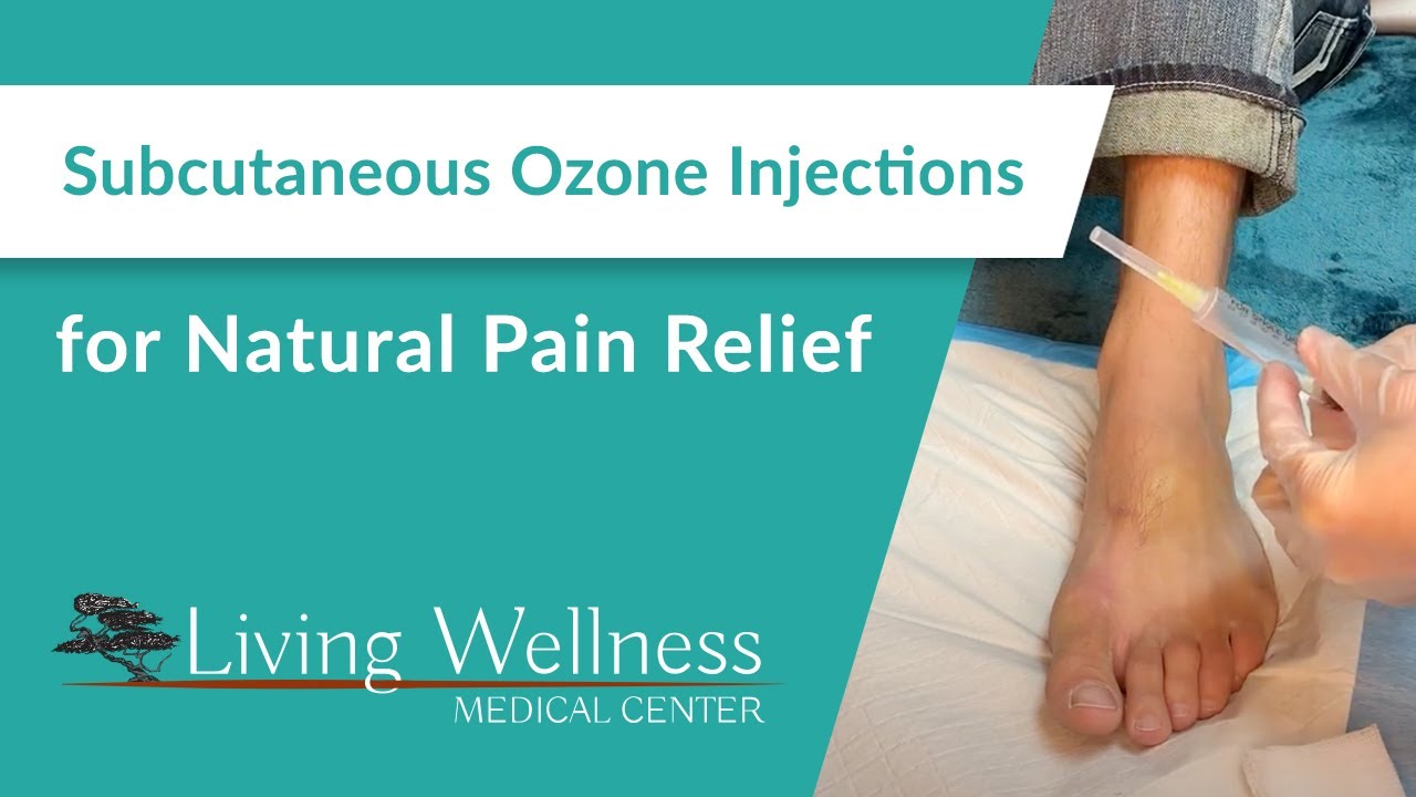Subcutaneous Ozone Injections for Natural Pain Relief