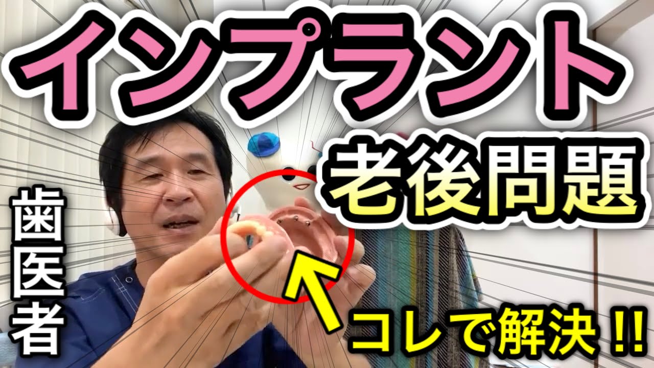 【インプラントのメンテナンス】老後はどうなる？│  歯医者直伝の解決策を公開‼︎