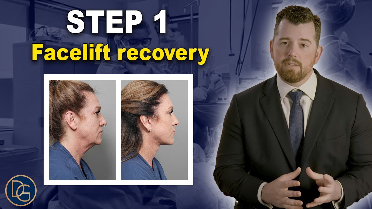 Facelift Recovery: Step-by-Step What to Expect
