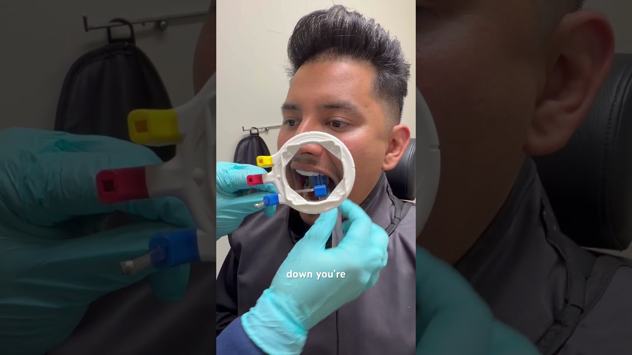 How to take the maxillary canine PA #dentalhygienestudent #dentist #xray #dentalhygiene