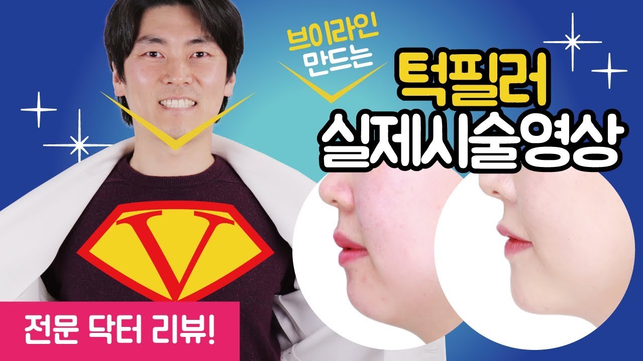 턱필러 - 실제 시술과정! 그기 알고 싶다
