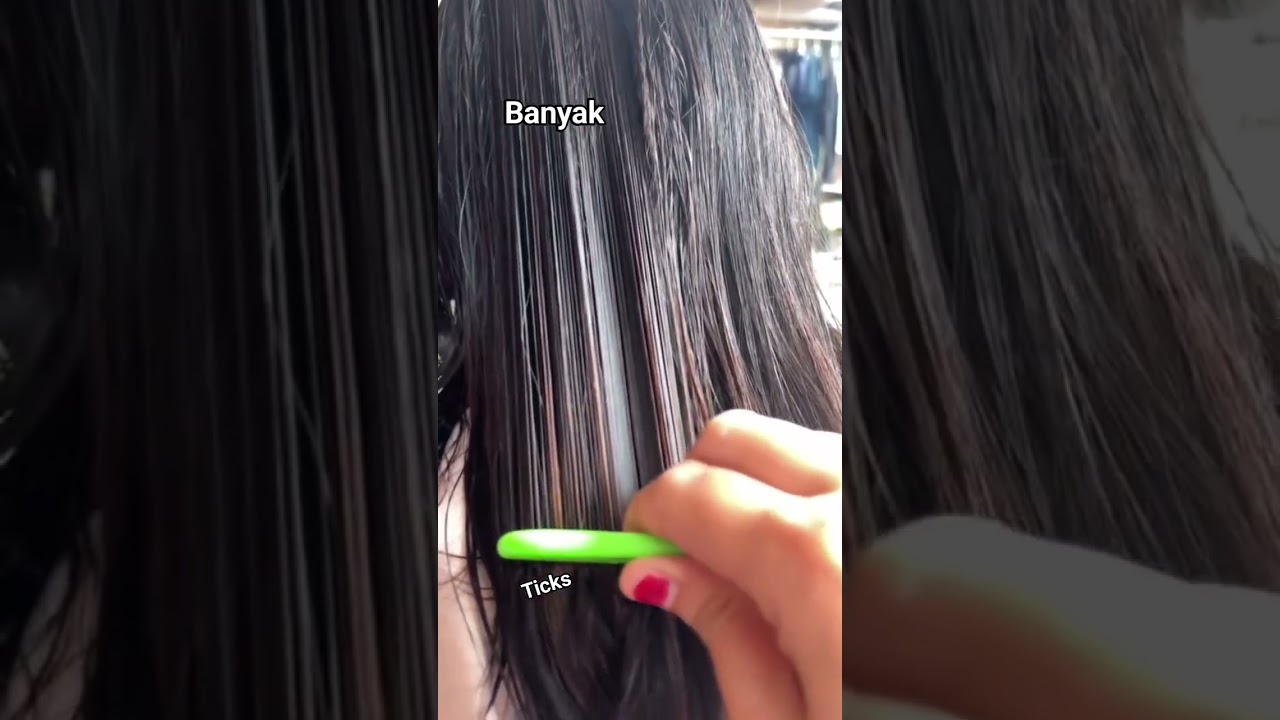 lice infestation #headliceremoval #licecomb #headlice #headlicetreatment #hairlice #haircare #hair