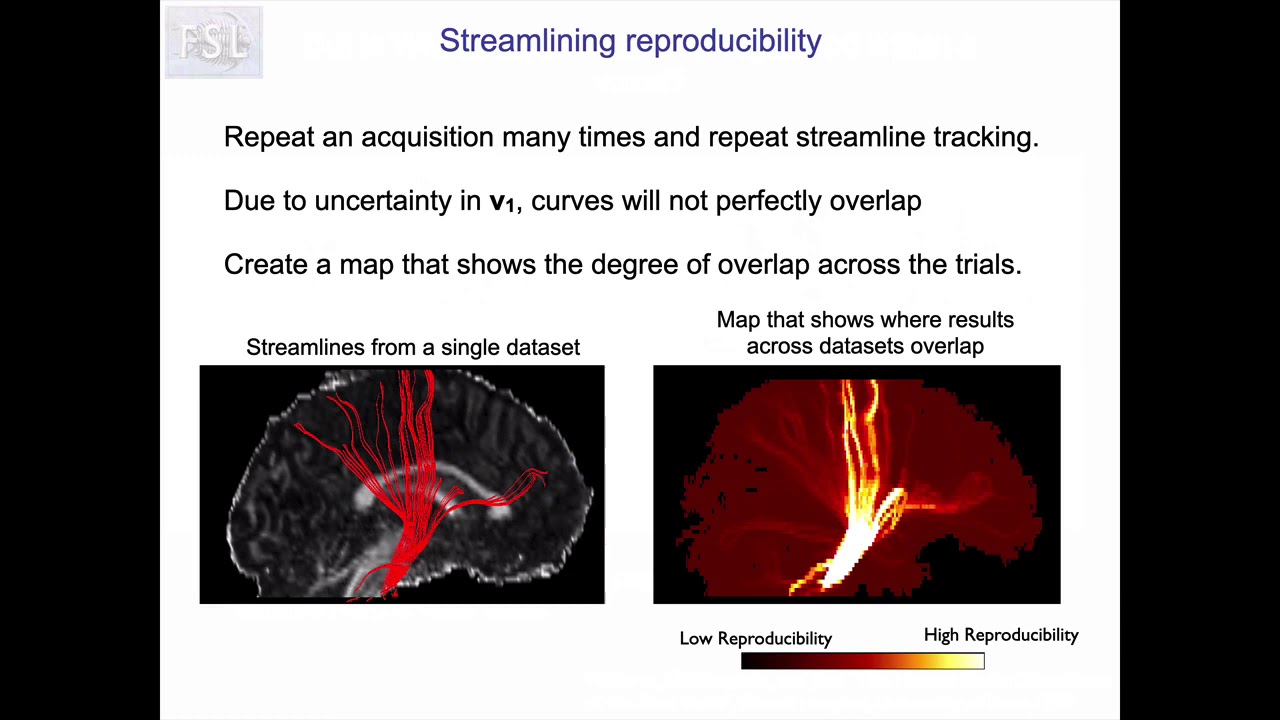 44. Diffusion Tractography: Probabilistic Tractography: PROBTRACKX (Tract E3)