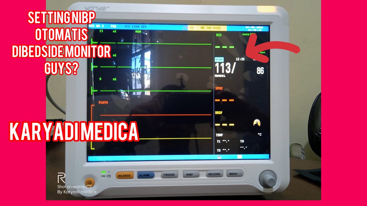 CARA MENSETTING PASIEN MONITOR DIBAGIAN NIBP | Tekanan darah secara Otomatis ~ Setting Otomatis