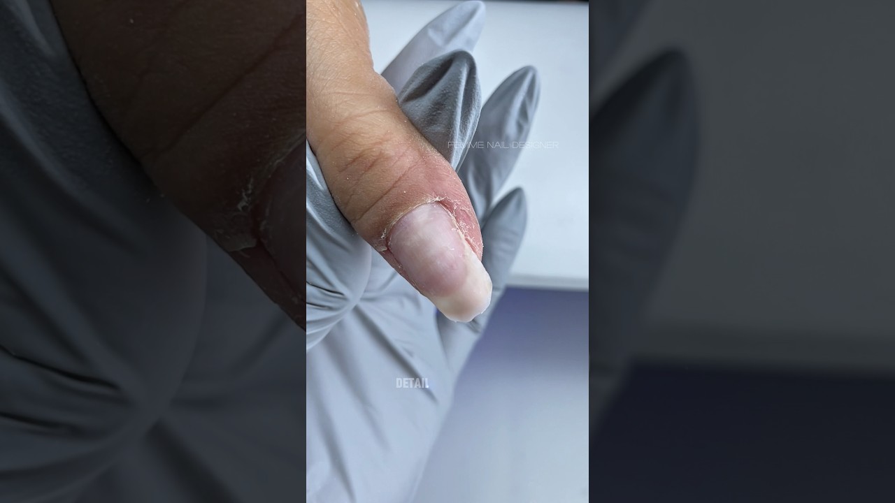 EXTREME DRY SKIN, FULL CUTICLE PREP