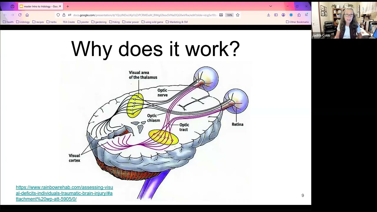 5 Questions to Ask BEFORE You Start Learning Iridology