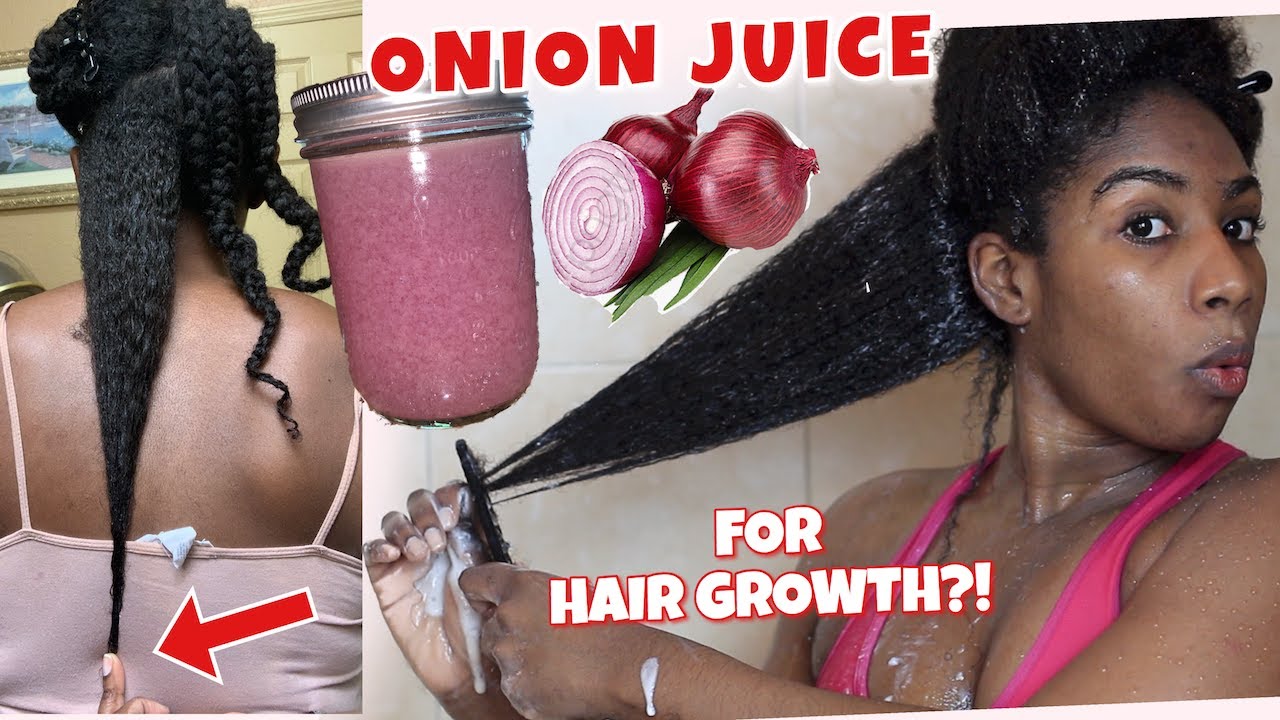 HOW TO USE ONION JUICE ON NATURAL HAIR FOR EXTREME HAIR GROWTH! | ONION JUICE RECIPE
