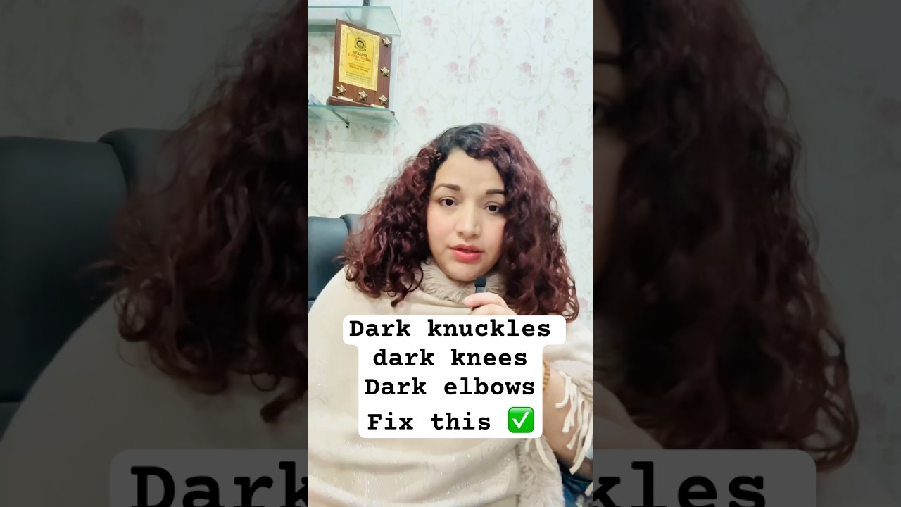 Dark Knuckles, Knees & Elbows | Doctor Approved Routine That Works 