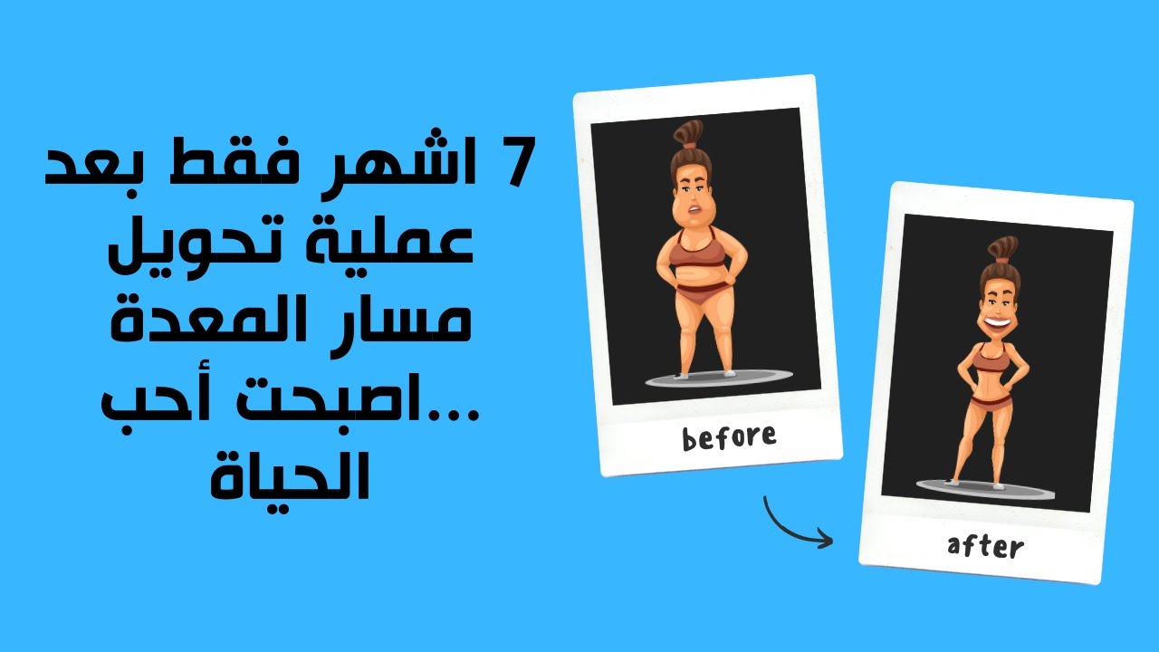 7اشهر فقط بعد عملية تحويل مسار المعدة ...اصبحت أحب الحياة