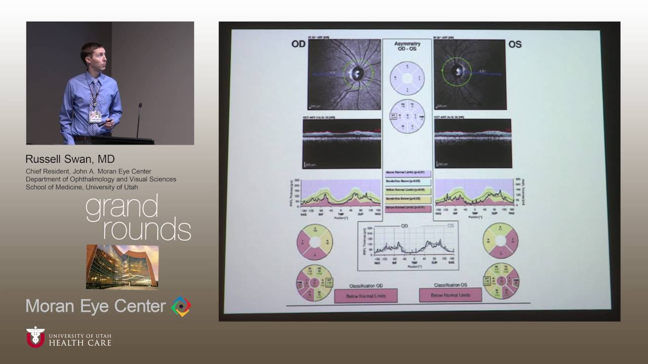 Autosomal Dominant Optic Atrophy