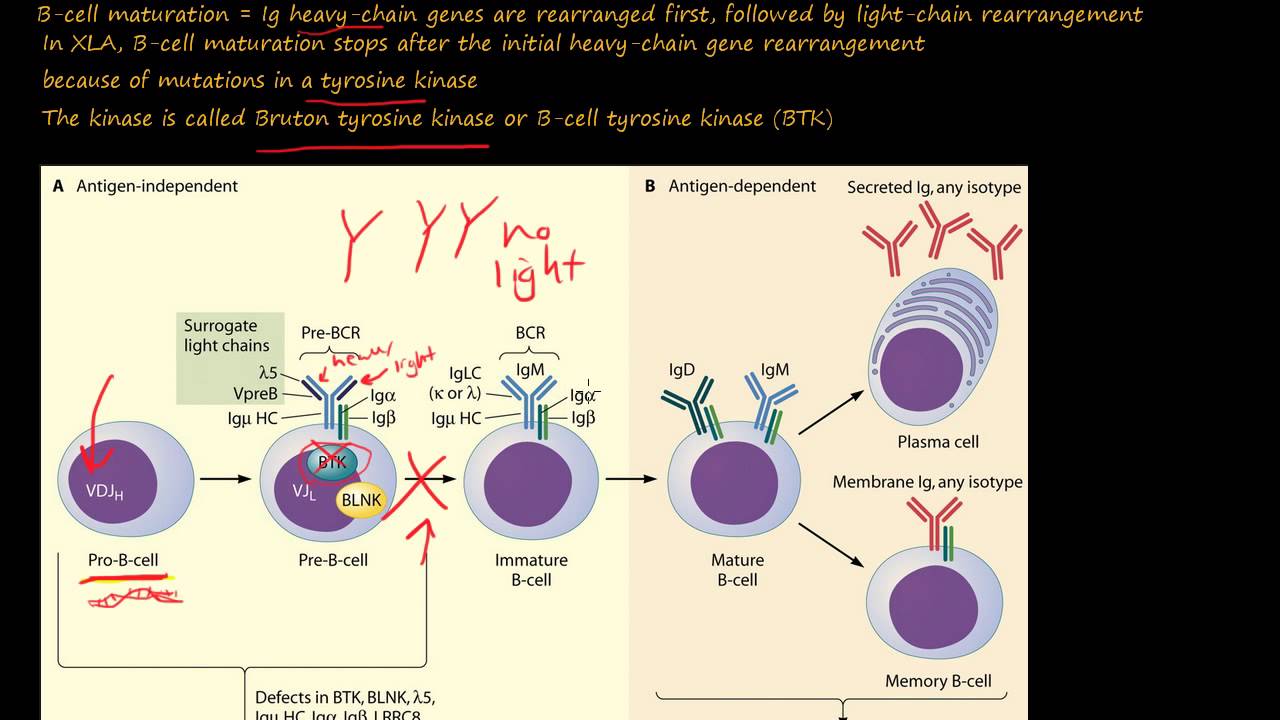 105P- What is X-Linked Agammaglobulinemia, XLA, or Bruton Disease?
