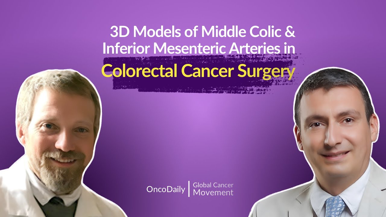 3D Models of Middle Colic & Inferior Mesenteric Arteries in Colorectal Cancer Surgery