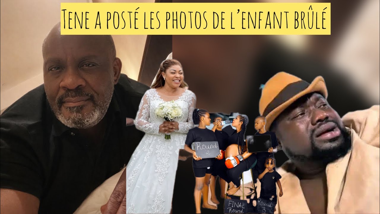 Tene poste les photos de l’enfant brûlé et dis qu’il est encore marié avec elle