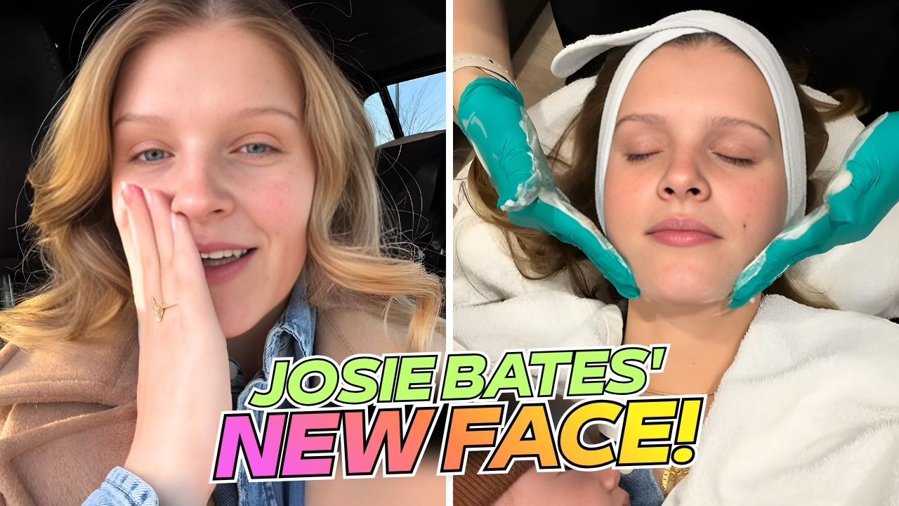 Bringing Up Bates | Did Josie Bates Get Botox? FANS THINK SO!