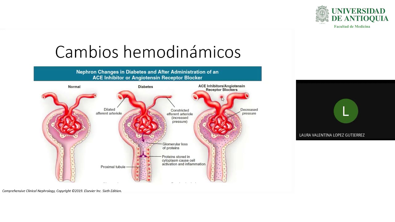 Enfermedad Renal Diabética - Dra. Laura Valentina López