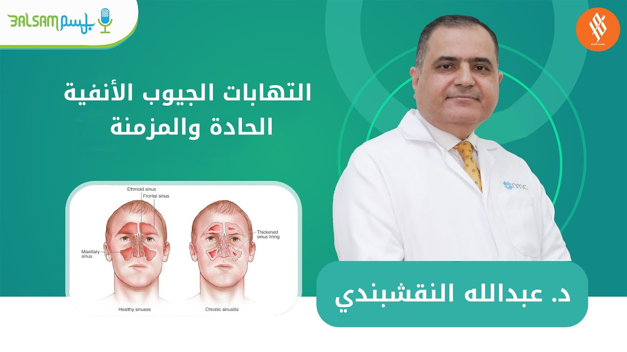 د. عبدالله النقشبندي I التهابات الجيوب الأنفية الحادة والمزمنة