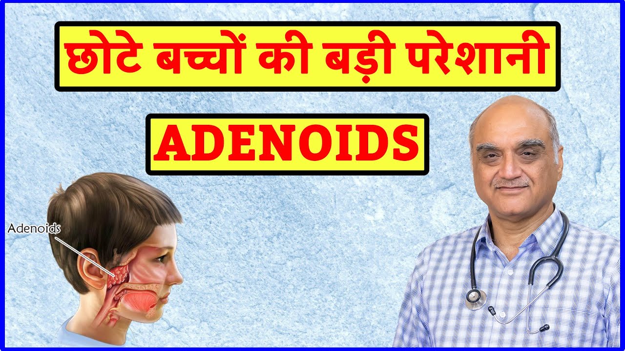 Adenoids kya hota hai । Enlarged adenoids । बच्चों में खराटे । Hindi